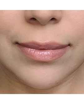 Gloss à lèvres sans gluten pour maladies auto-immunes